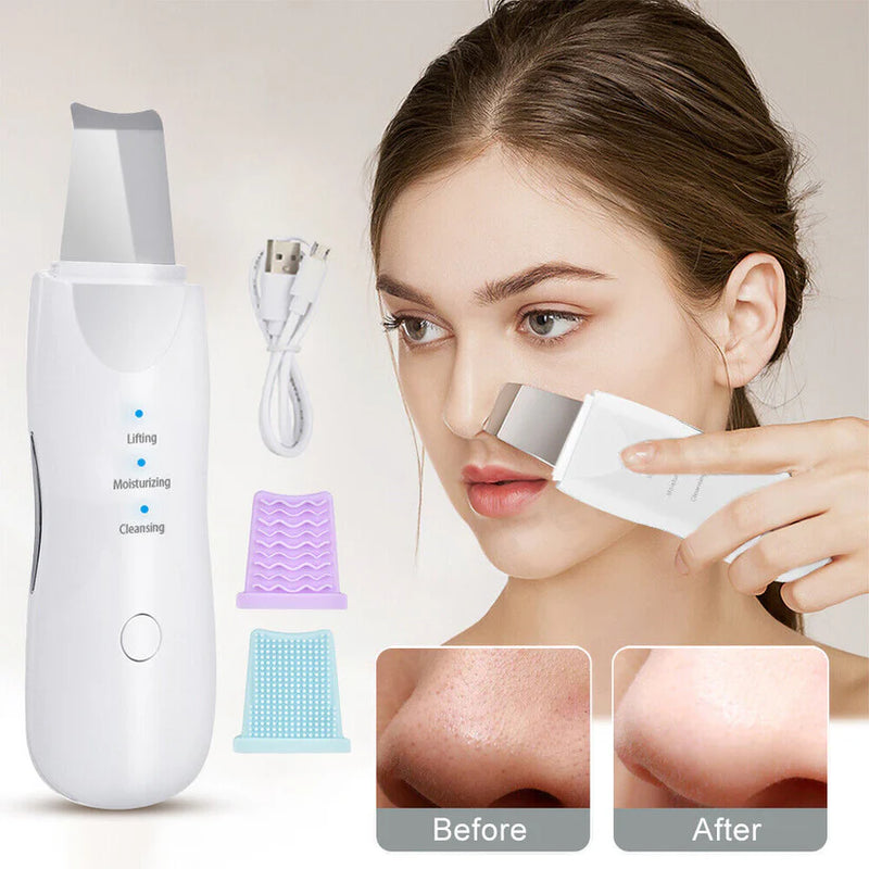 Rechargeable Ultra Sonic Blackheads Remover